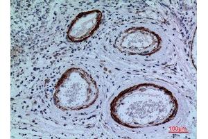 Immunohistochemistry (IHC) analysis of paraffin-embedded Human Brain, antibody was diluted at 1:100. (CYP11A1 anticorps  (C-Term))