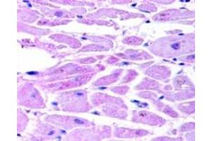 Immunohistochemical staining (Formalin-fixed paraffin-embedded sections) of human cardiac myocytes with EPAS1 polyclonal antibody . (EPAS1 anticorps  (C-Term))