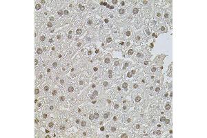 Immunohistochemistry of paraffin-embedded mouse liver using ZNF408 antibody (ABIN5974874) at dilution of 1/100 (40x lens). (ZNF408 anticorps)
