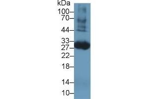 Detection of TF in Rat Blood Cells lysate using Polyclonal Antibody to Tissue Factor (TF)