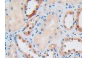 DAB staining on IHC-P; Samples: Human Kidney Tissue (IGF2R anticorps  (AA 2167-2442))