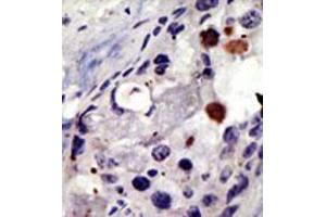 Image no. 2 for anti-Proteasome (Prosome, Macropain) 26S Subunit, Non-ATPase, 4 (Psmd4) (C-Term) antibody (ABIN357468)