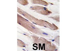 Formalin-fixed and paraffin-embedded human skeletal muscle tissue reacted with PIK3R1 polyclonal antibody  , which was peroxidase-conjugated to the secondary antibody, followed by DAB staining. (PIK3R1 anticorps  (Tyr580))