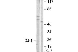 Western blot analysis of extracts from HuvEc cells, using DJ-1 antibody (ABIN5976380).