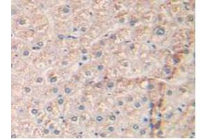 IHC-P analysis of Human Liver Tissue, with DAB staining. (EGFR anticorps  (AA 713-984))