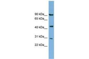 Image no. 1 for anti-Nitrogen Permease Regulator-Like 2 (S. Cerevisiae) (NPRL2) (AA 287-336) antibody (ABIN6742041) (NPRL2 anticorps  (AA 287-336))
