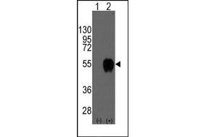 Western blot analysis of CD14(arrow) using rabbit polyclonal CD14 Antibody (CD14 anticorps  (N-Term))