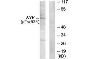 Western blot analysis of extracts from A549 cells, using SYK (Phospho-Tyr525) Antibody. (SYK anticorps  (pTyr525))
