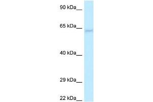 WB Suggested Anti-LGI1 Antibody Titration: 1. (LGI1 anticorps  (N-Term))