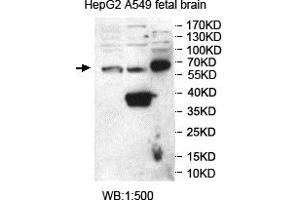 Western blot analysis of HepG2, A549 and fetal brain lysates, using SNTG2 antibody. (SNTG2 anticorps  (AA 143-324))