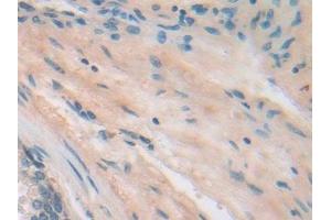 Detection of ITGb5 in Human Prostate Tissue using Polyclonal Antibody to Integrin Beta 5 (ITGb5)