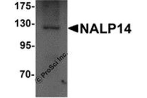 Western Blotting (WB) image for anti-NLR Family, Pyrin Domain Containing 14 (NLRP14) (N-Term) antibody (ABIN1031469) (NLRP14 anticorps  (N-Term))