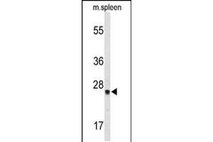 Western blot analysis of TPK1 Antibody in mouse spleen tissue lysates (35ug/lane)