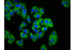 Immunofluorescence staining of HepG2 cells with ABIN7167509 at 1:133, counter-stained with DAPI. (PTPRK anticorps  (AA 589-749))