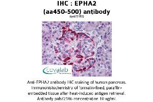 Image no. 1 for anti-EPH Receptor A2 (EPHA2) (AA 450-500) antibody (ABIN1734074) (EPH Receptor A2 anticorps  (AA 450-500))