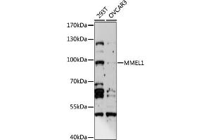 Western blot analysis of extracts of various cell lines, using MMEL1 antibody (ABIN6293386) at 1:1000 dilution. (MMEL1 anticorps)