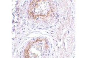 Immunohistochemistry of TEM5 in human bladder tissue with this product at 5 μg/ml. (GPR124 anticorps  (C-Term))