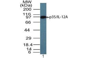 Image no. 1 for anti-Interleukin 12 alpha (IL12A) (AA 200-250) antibody (ABIN960224) (IL12A anticorps  (AA 200-250))