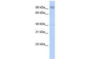 TTC14 anticorps  (N-Term)