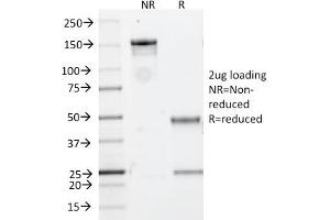 Immunofluorescence staining of Raji cells using CD20 Mouse Recombinant Monoclonal Antibody (rIGEL/773) followed by goat anti-mouse IgG-CF488 (green). (Recombinant CD20 anticorps)