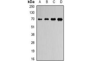 Western blot analysis of ATAD3B expression in NIH3T3 (A), mouse heart (B), mouse spleen (C), rat brain (D) whole cell lysates.