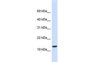 Image no. 1 for anti-Chromosome 1 Open Reading Frame 95 (C1ORF95) (C-Term) antibody (ABIN6740873) (C1ORF95 anticorps  (C-Term))