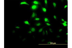 Immunofluorescence of monoclonal antibody to CLIC3 on HeLa cell.