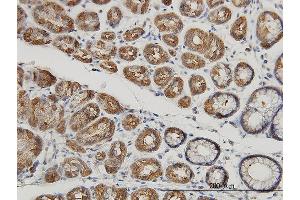 Immunoperoxidase of monoclonal antibody to MUC4 on formalin-fixed paraffin-embedded human stomach.