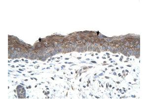 LOC400856 antibody was used for immunohistochemistry at a concentration of 4-8 ug/ml to stain Squamous epithelial cells (arrows) in Human Skin. (LOC400856 anticorps  (C-Term))