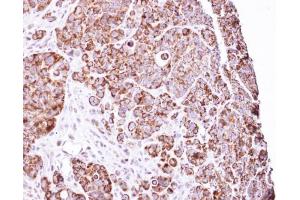 IHC-P Image Immunohistochemical analysis of paraffin-embedded SW480 Xenograft, using LRP130 , antibody at 1:100 dilution. (LRPPRC anticorps)