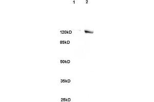 L1 rat brain, L2 human colon carcinoma lysates probed (ABIN741705) at 1:200 in 4 °C.