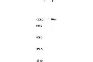 L1 rat brain, L2 human colon carcinoma lysates probed (ABIN741705) at 1:200 in 4 °C. (SREBF2 anticorps)