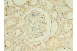 Immunohistochemistry of paraffin-embedded human kidney tissue using ABIN7155229 at dilution of 1:100 (HIATL1 anticorps  (AA 450-506))