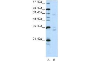 WB Suggested Anti-ZNF440 Antibody Titration:  2. (ZNF440 anticorps  (N-Term))