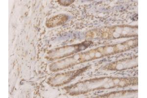 Immunoperoxidase of monoclonal antibody to WDR58 on formalin-fixed paraffin-embedded human small Intestine.