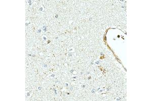 Immunohistochemistry of paraffin-embedded human brain using MMP7 Rabbit mAb (ABIN7268425) at dilution of 1:150 (40x lens). (MMP7 anticorps)