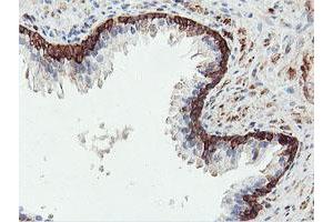 Image no. 1 for anti-phosphofructokinase, Platelet (PFKP) antibody (ABIN1500160) (PFKP anticorps)