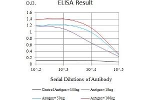 Black line: Control Antigen (100 ng),Purple line: Antigen (10 ng), Blue line: Antigen (50 ng), Red line:Antigen (100 ng)