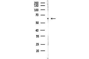 anti-Metadherin (MTDH) (C-Term) antibody