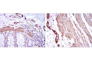 Immunohistochemical analysis of paraffin-embedded human duodenum tissues (left) and human esophagus tissues (right) using ACTA2 mouse mAb with DAB staining.
