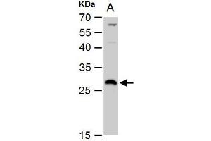 WB Image DCK antibody detects DCK protein by western blot analysis. (DCK anticorps  (Center))