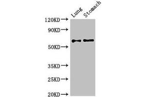 Western Blot Positive WB detected in: Mouse lung tissue, Mouse stomach tissue All lanes: GAD2 antibody at 2.