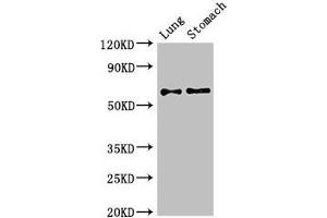 Western Blot Positive WB detected in: Mouse lung tissue, Mouse stomach tissue All lanes: GAD2 antibody at 2. (GAD65 anticorps  (AA 1-82))