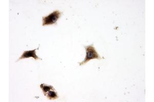 IHC analysis of SQSTM1 using anti-SQSTM1 antibody (ABIN3043937). (SQSTM1 anticorps  (N-Term))