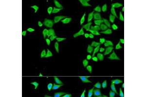 Immunofluorescence analysis of MCF-7 cells using CES2 Polyclonal Antibody (CES2 anticorps)