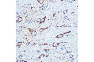 Immunohistochemistry of paraffin-embedded mouse brain using NMD Rabbit pAb (ABIN6133733, ABIN6141400, ABIN6141403 and ABIN6223602) at dilution of 100 (40x lens). (GRIN1/NMDAR1 anticorps  (AA 600-700))