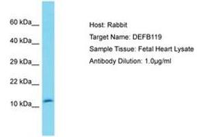 Image no. 1 for anti-Defensin, beta 119 (DEFB119) (N-Term) antibody (ABIN6750557)