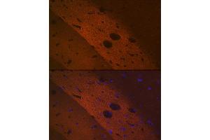 Immunofluorescence analysis of rat brain using mGluR2 Rabbit mAb (ABIN1682570, ABIN3017965, ABIN3017966 and ABIN7101551) at dilution of 1:100 (40x lens). (GRM2 anticorps)