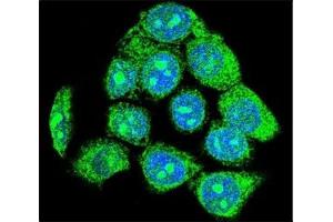 Confocal immunofluorescent analysis of EGR1 antibody with HeLa cells followed by Alexa Fluor 488-conjugated goat anti-rabbit lgG (green).