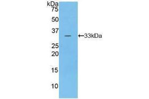 Western blot analysis of recombinant Human PKN1. (PKN1 anticorps  (AA 615-874))